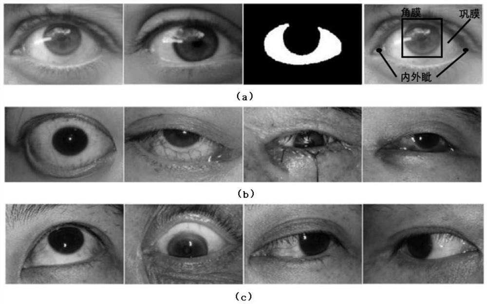Deep learning-based ophthalmic parameter measuring method and system and equipment