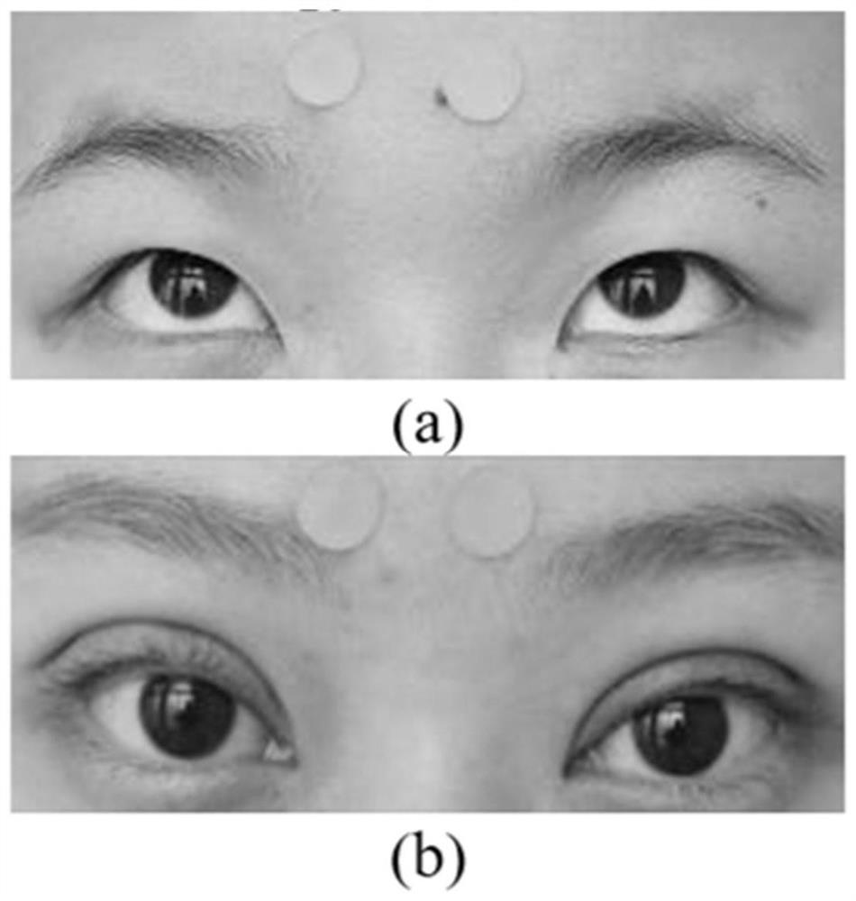 Deep learning-based ophthalmic parameter measuring method and system and equipment