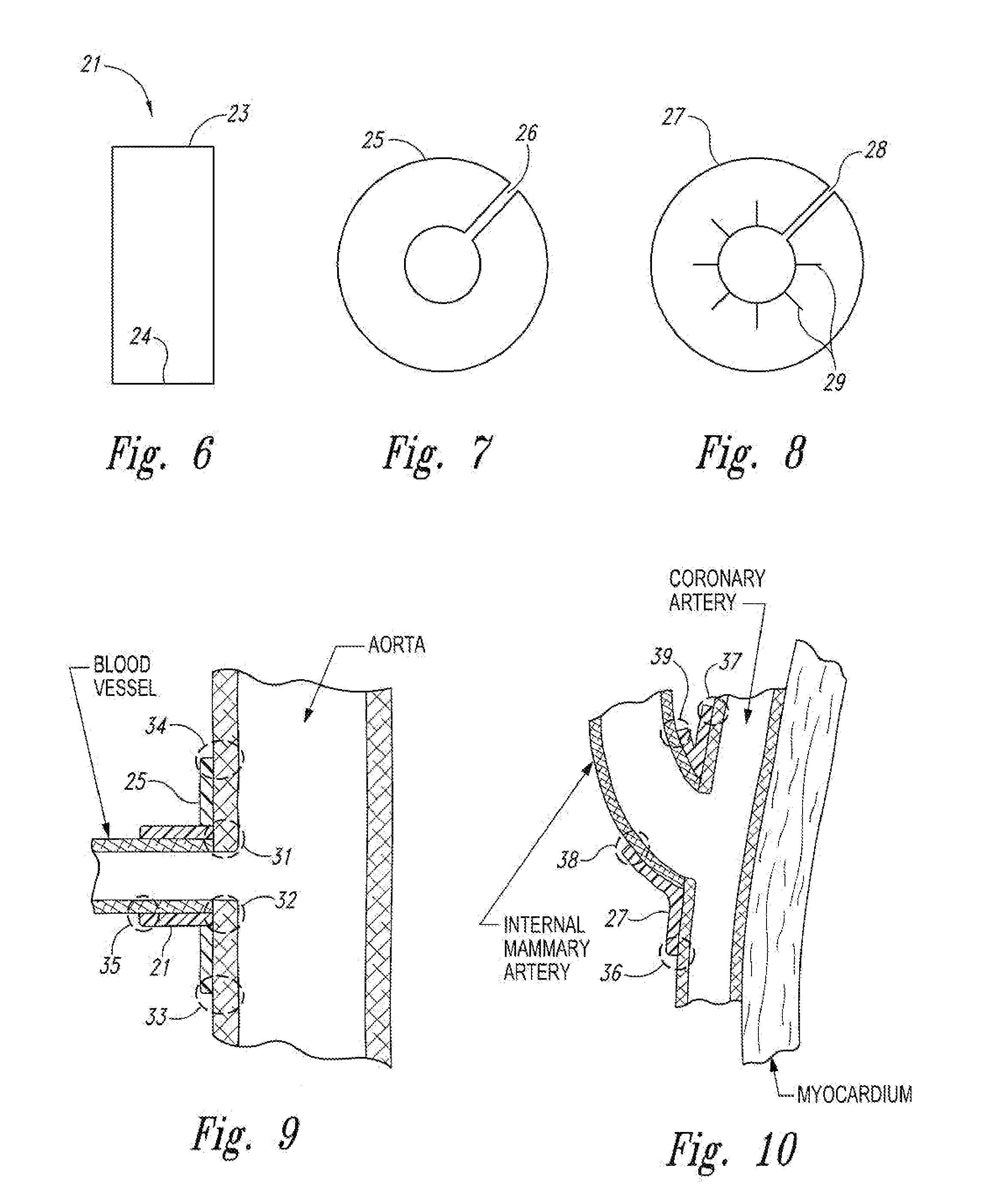 Devices and methods for reducing scar tissue formation
