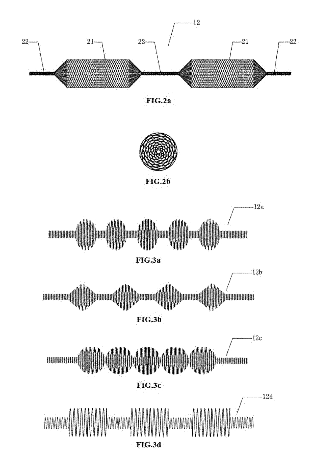 Stent delivery system, corresponding flow diversion device, and assembly method of flow diversion device