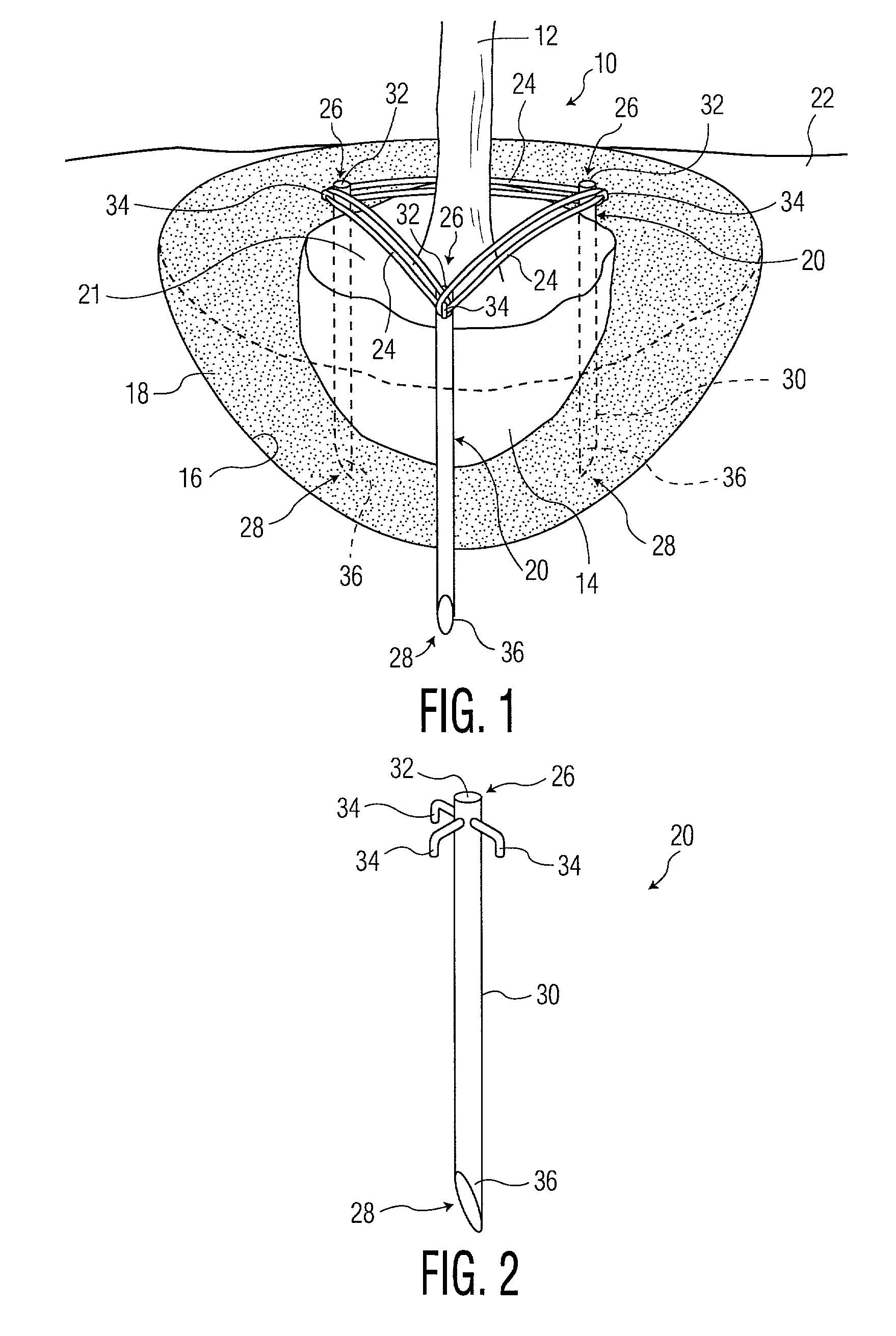 Tree and shrub stabilizing apparatus and method for stabilizing a tree or shrub