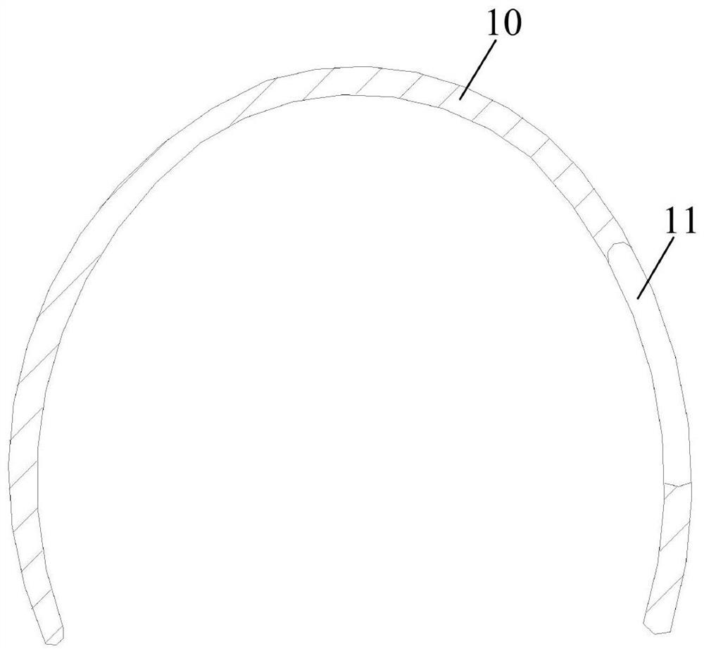 Design method and preparation method of tooth correction system