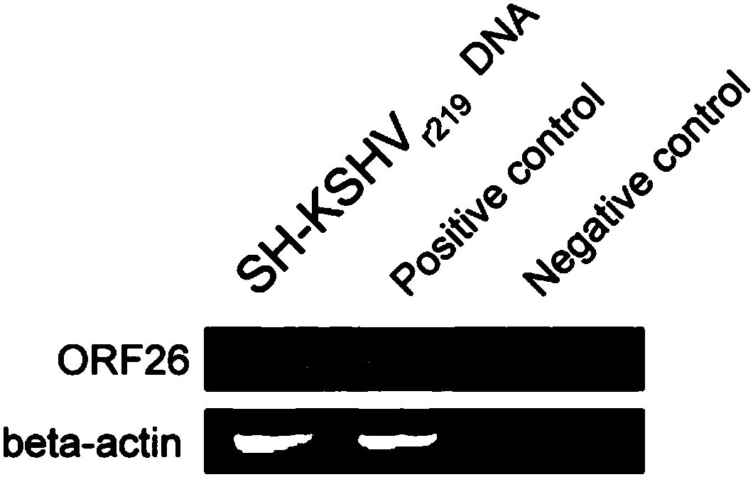 Method for constructing neurons with spontaneous KSHV (Kaposi's Sarcoma-Associated Herpesvirus) lytic replication