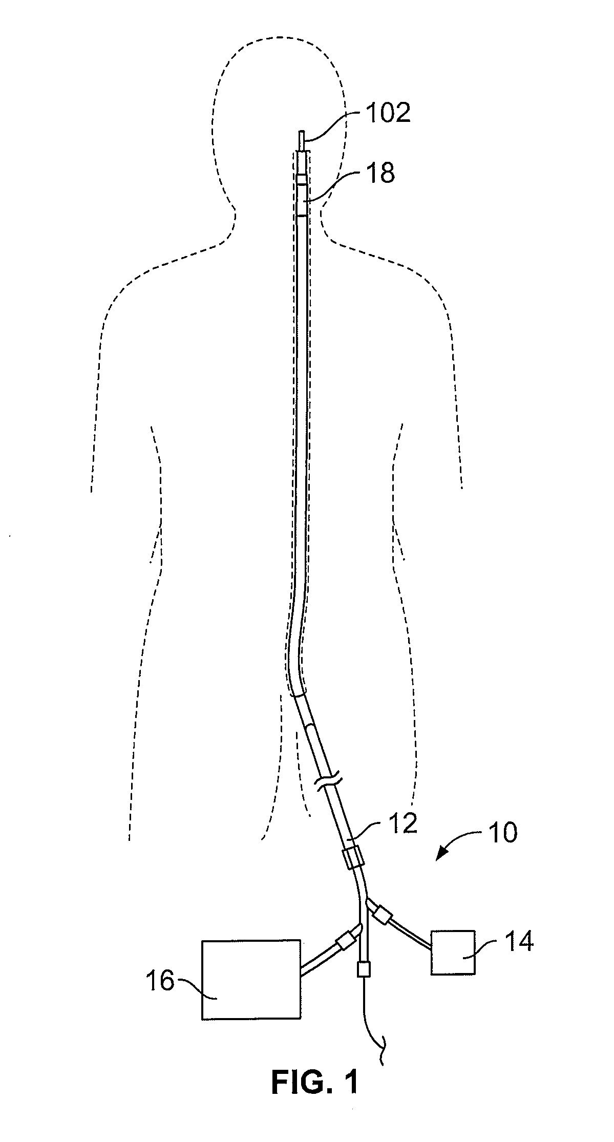 Devices for restoring blood flow within blocked vasculature