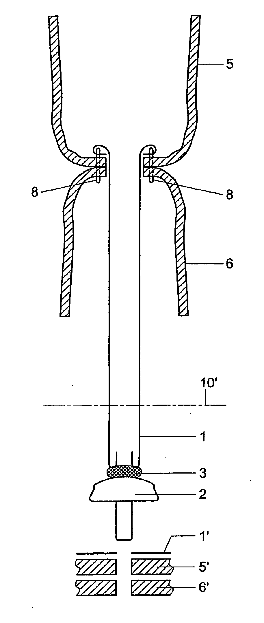 Devices and methods for anastomosis