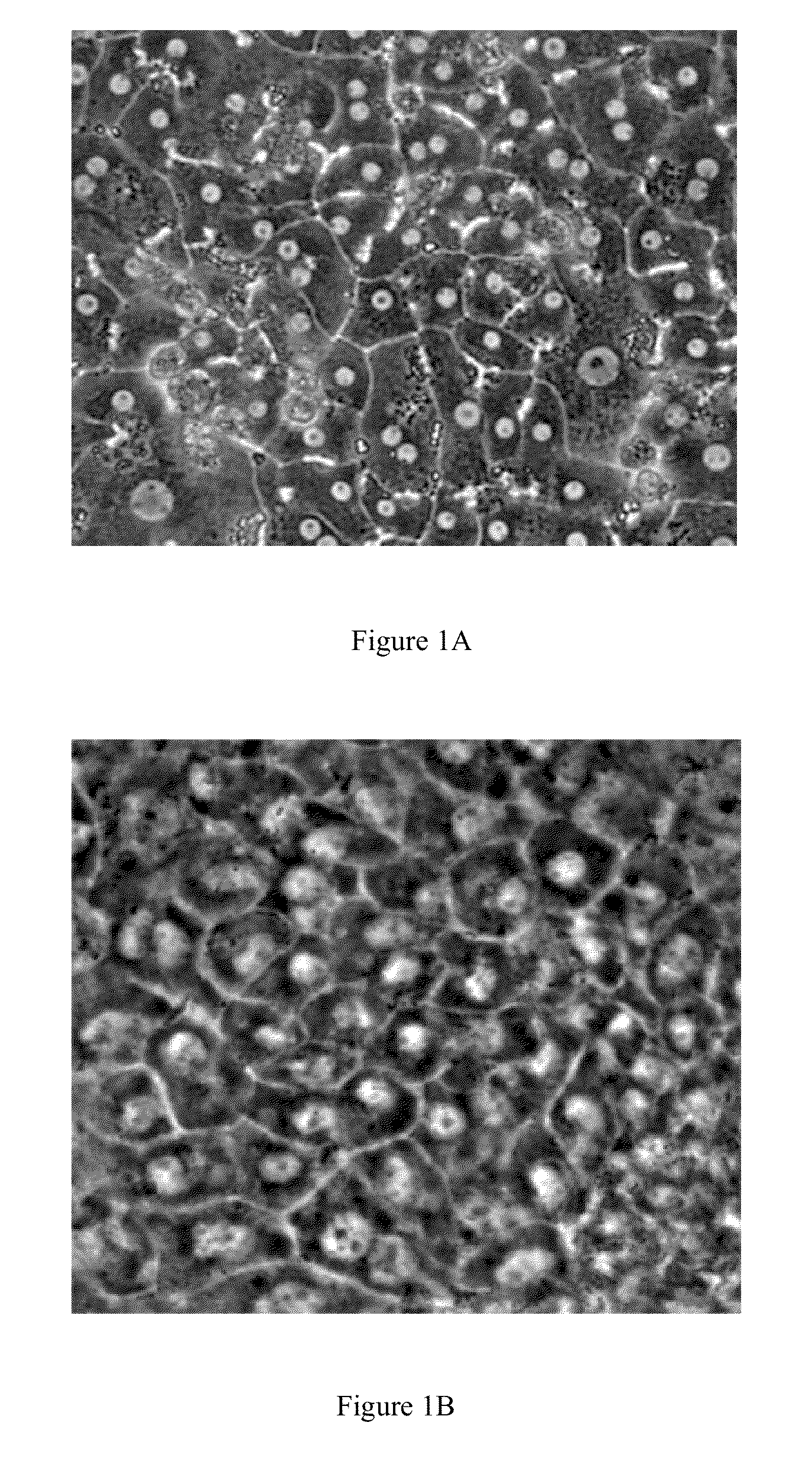 Method of deriving mature hepatocytes from human embryonic stem cells