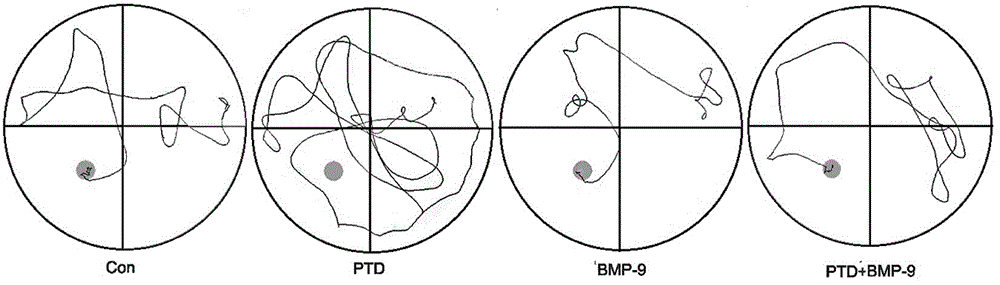 Application of bone morphogenetic protein-9 in preparing pharmaceutical composition for treating and/or preventing cholinergic system degeneration related diseases