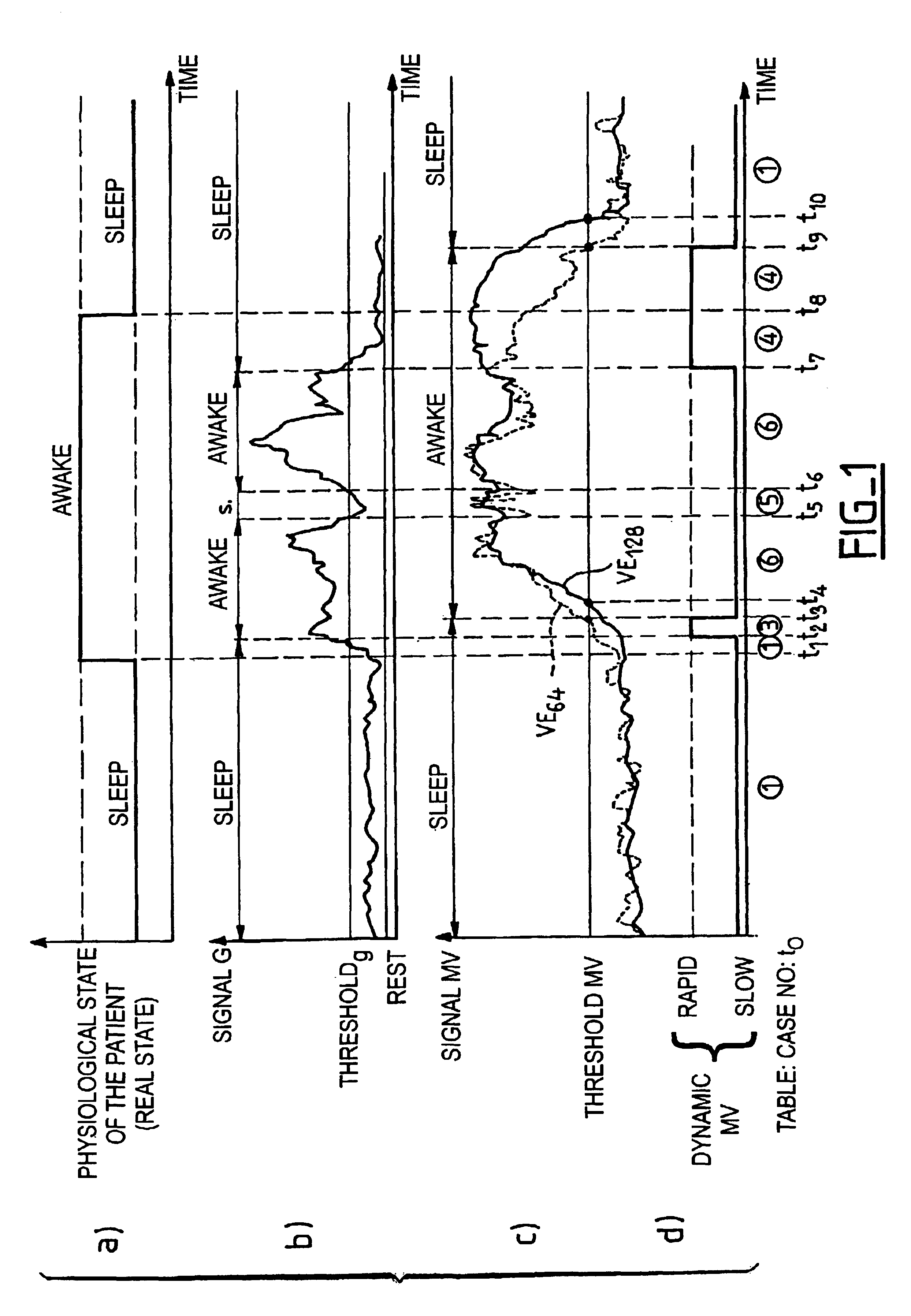 Active medical device for the diagnosis of the sleep apnea syndrome