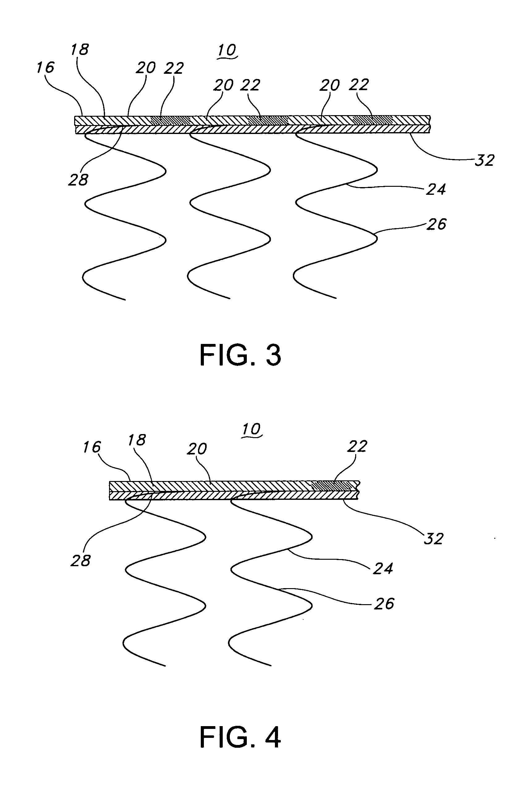 Stent-graft having flexible geometries and methods of producing the same