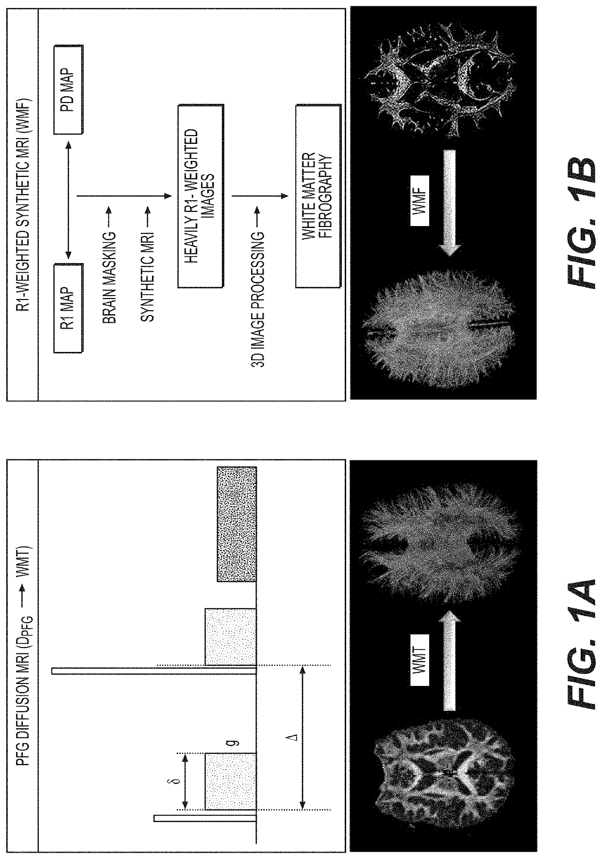 White matter fibrography by synthetic magnetic resonance imaging