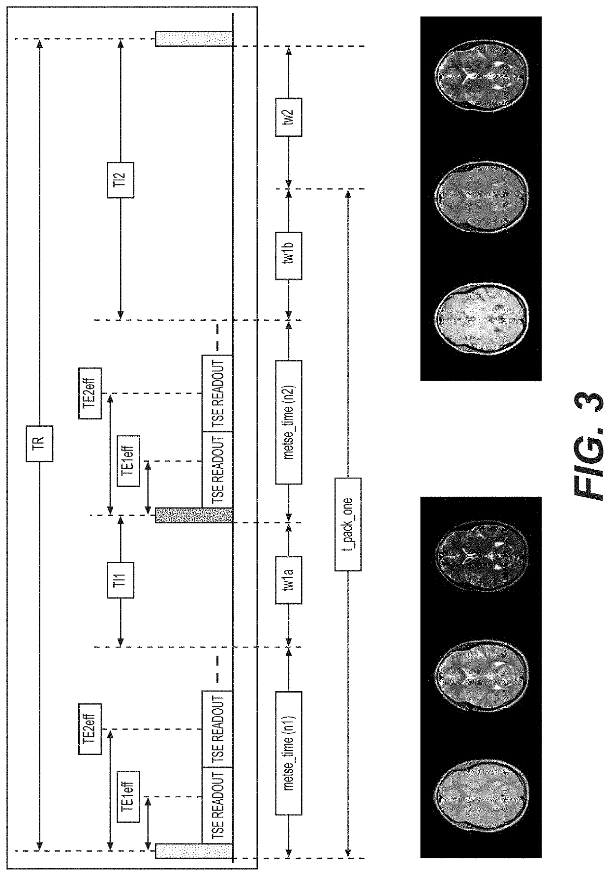 White matter fibrography by synthetic magnetic resonance imaging