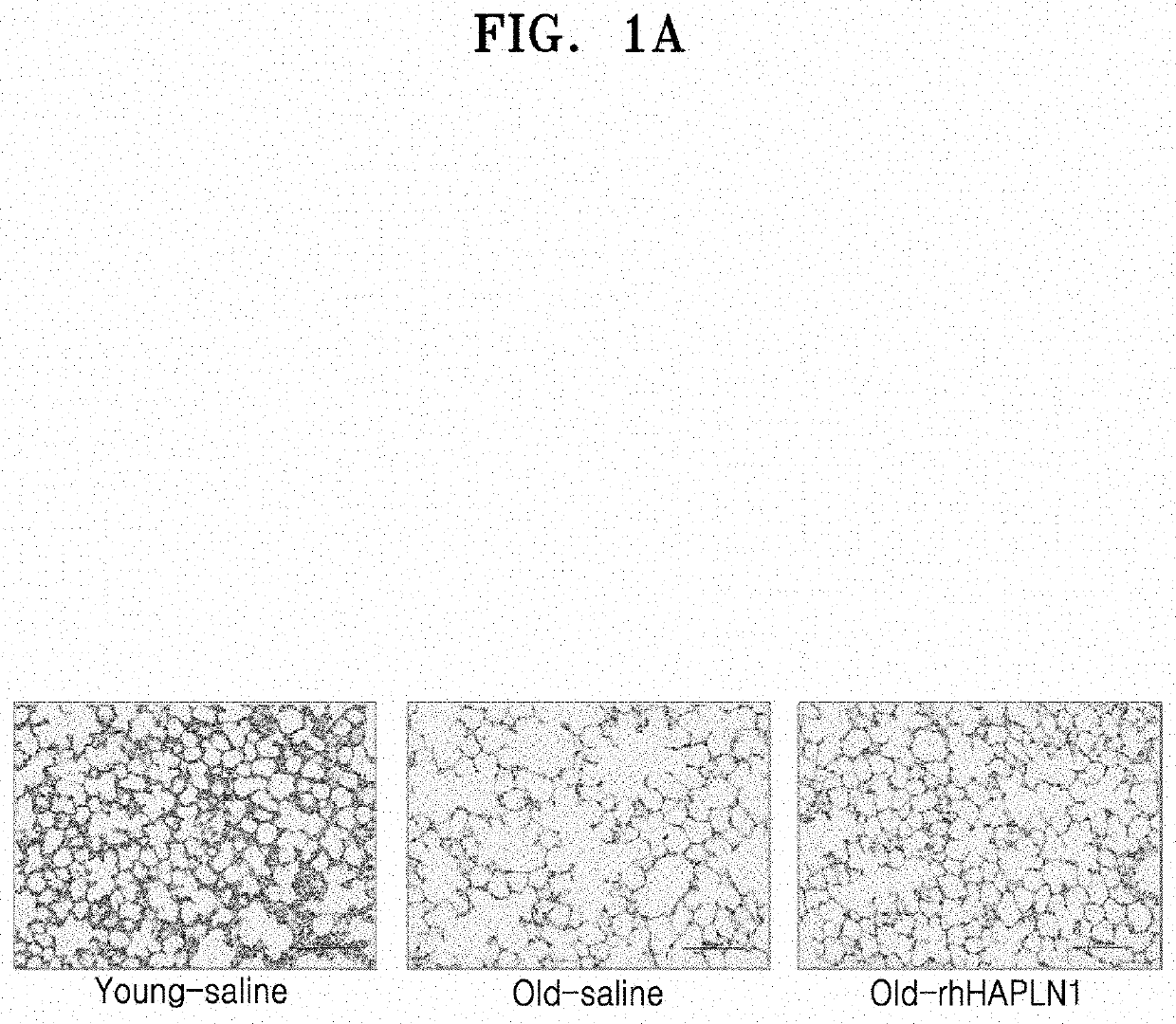 Composition for preventing or treating pulmonary diseases comprising hyaluronan and proteoglycan link protein 1