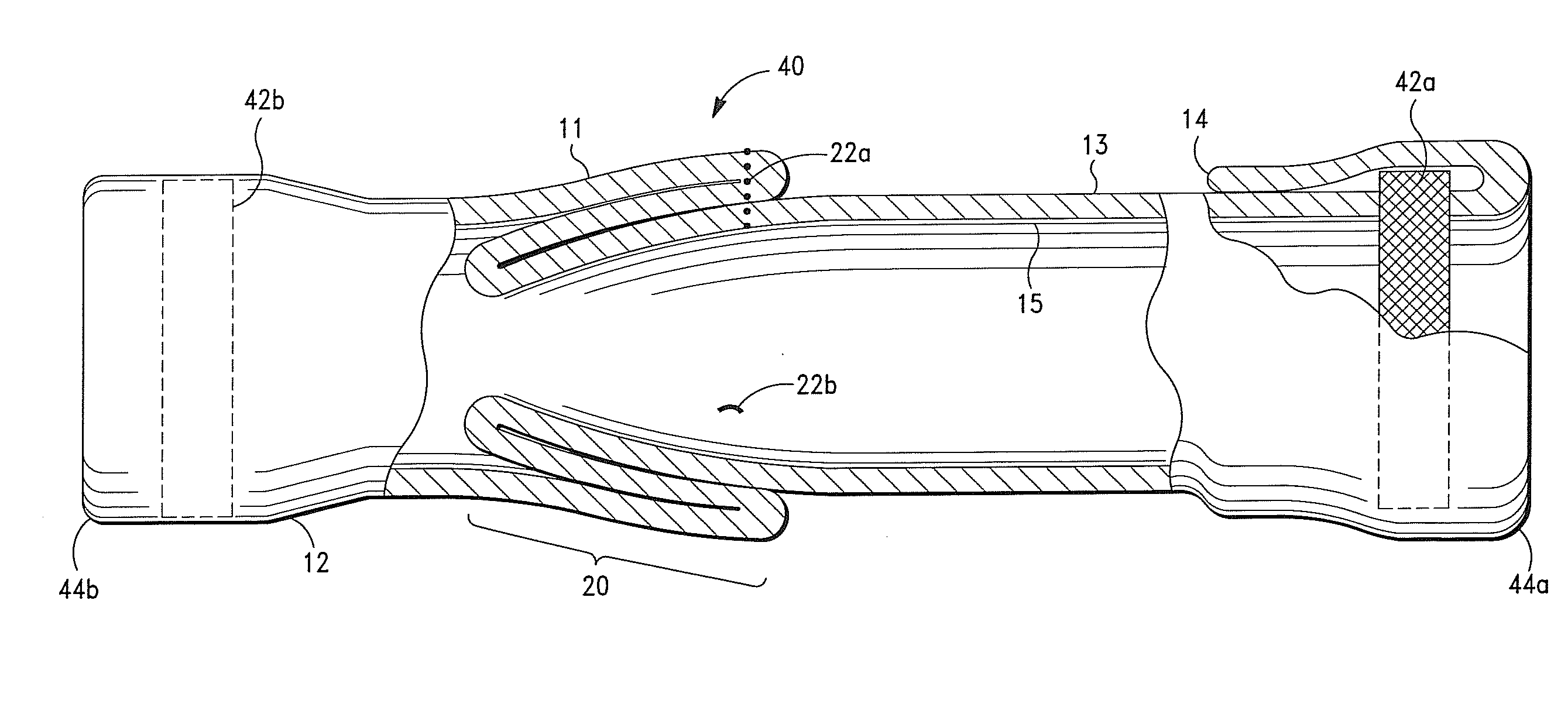 Seamless Tubular Extracellular Matrix Prosthetic Valve and Method for Forming Same