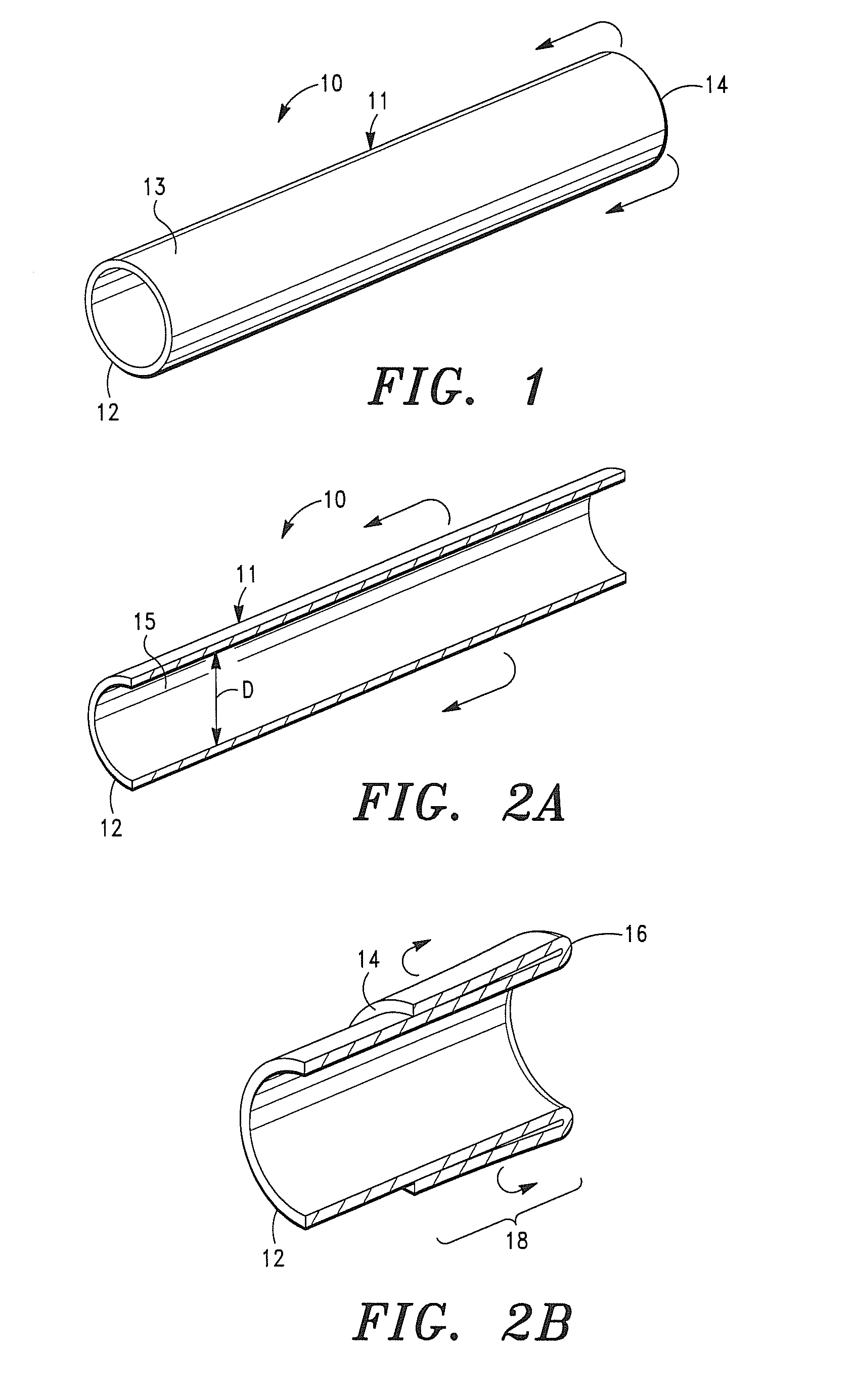 Seamless Tubular Extracellular Matrix Prosthetic Valve and Method for Forming Same