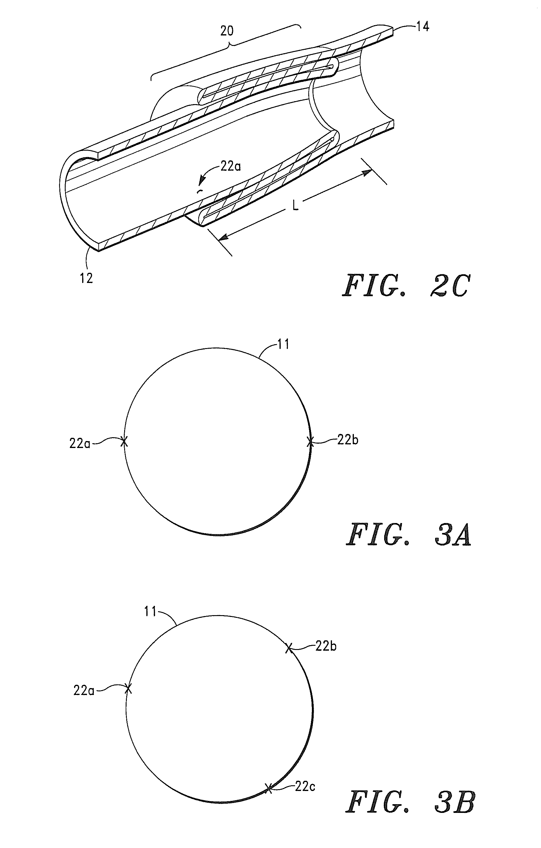 Seamless Tubular Extracellular Matrix Prosthetic Valve and Method for Forming Same