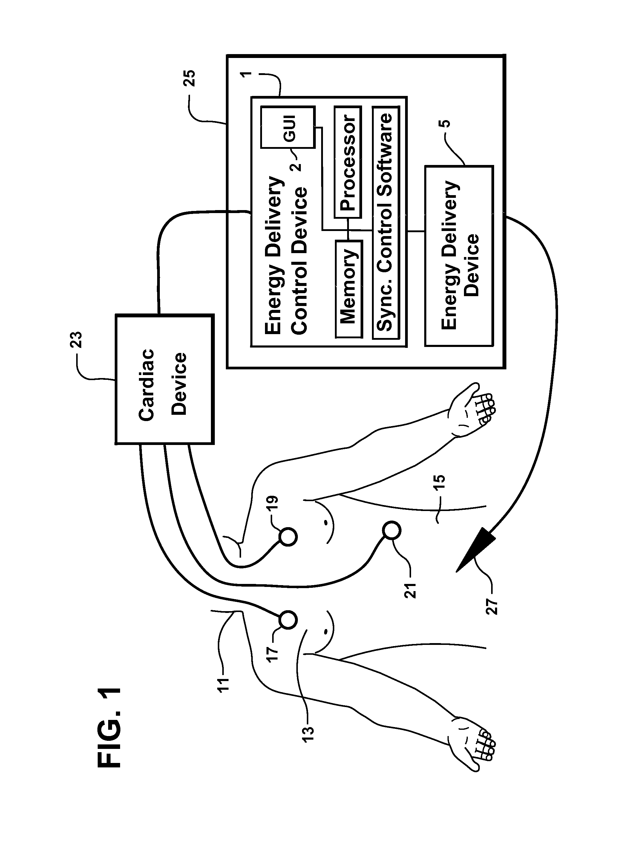 System and Method for Synchronizing Energy Delivery to the Cardiac Rhythm