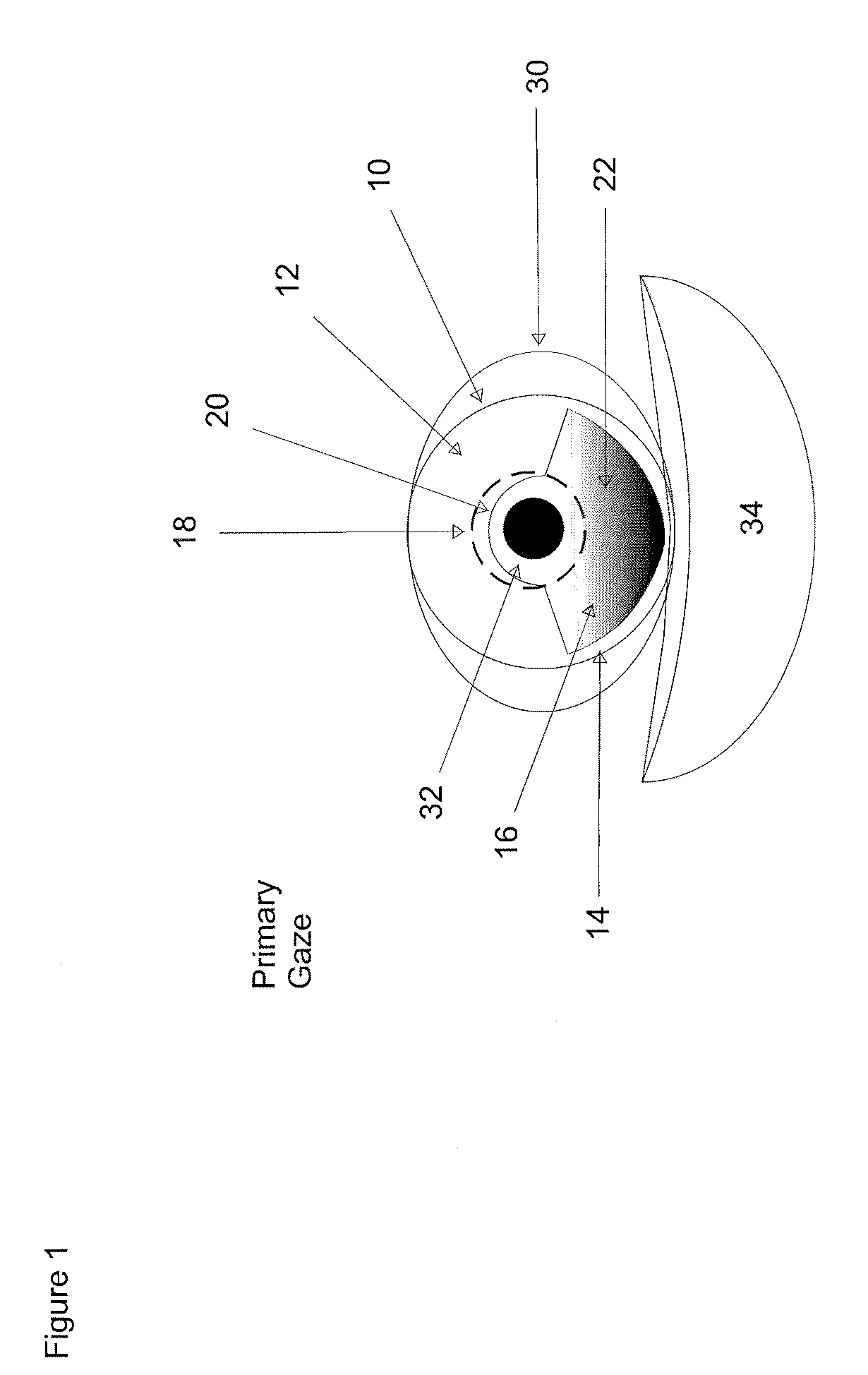 Hydrodynamically operated multifocal contact lens