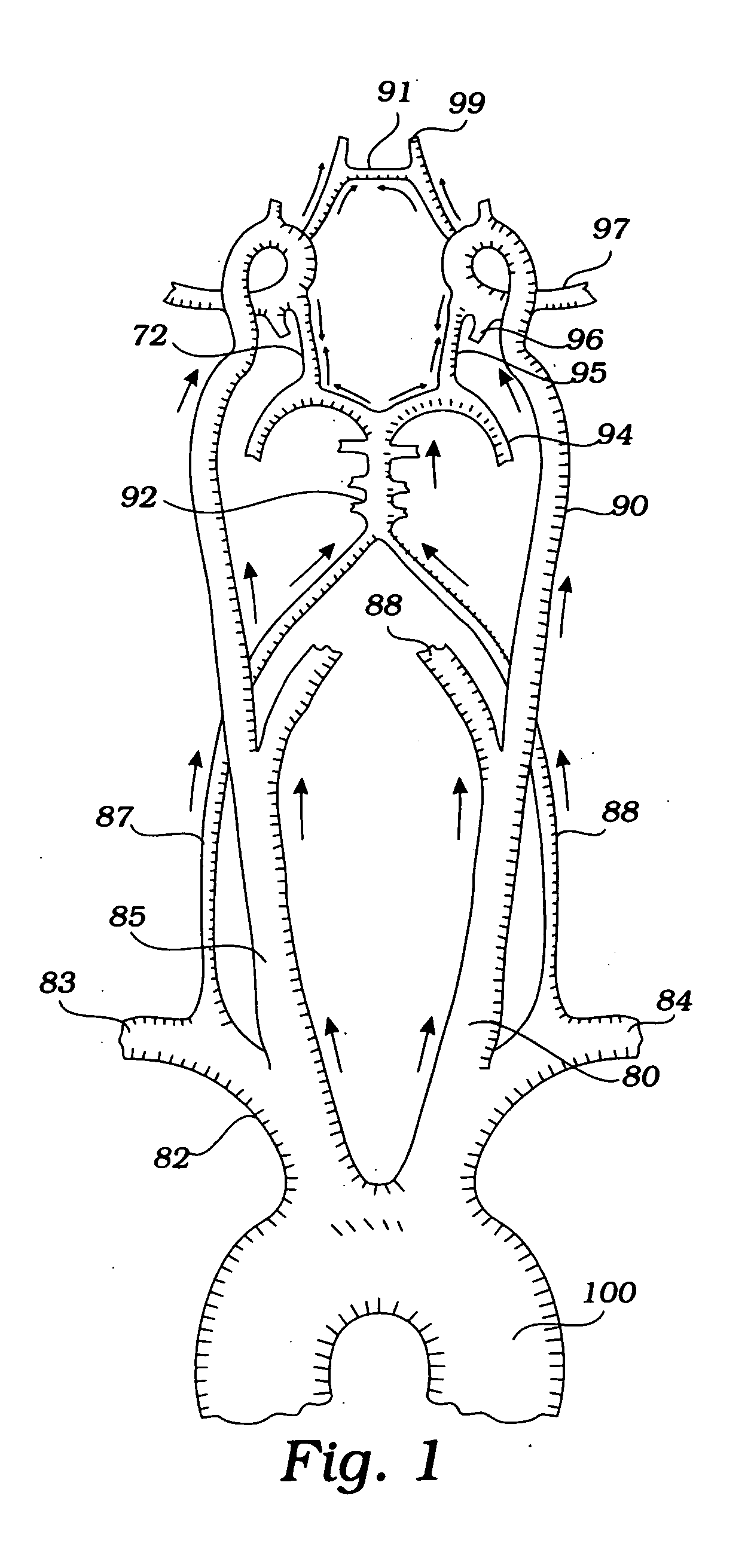 Devices and methods for preventing distal embolization using flow reversal and perfusion augmentation within the cerebral vasculature