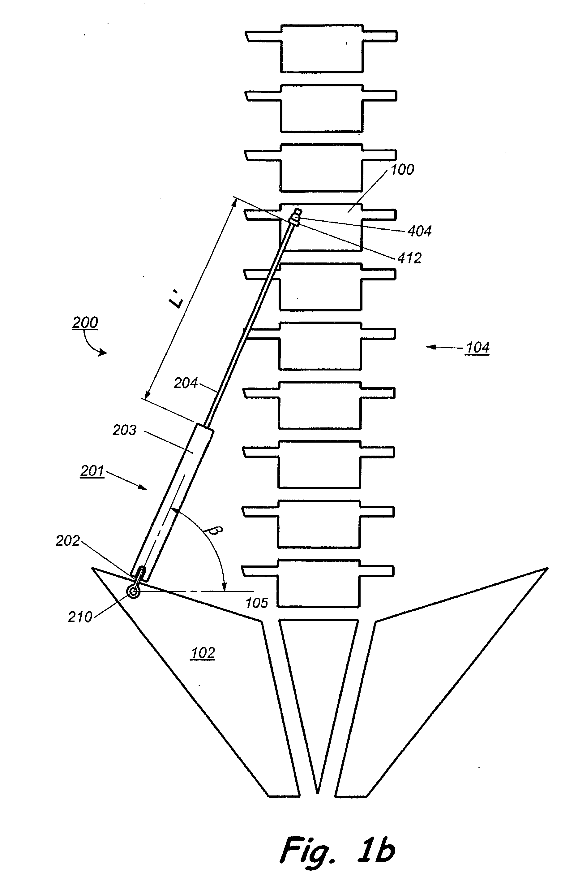 Implant for correction of spinal deformity