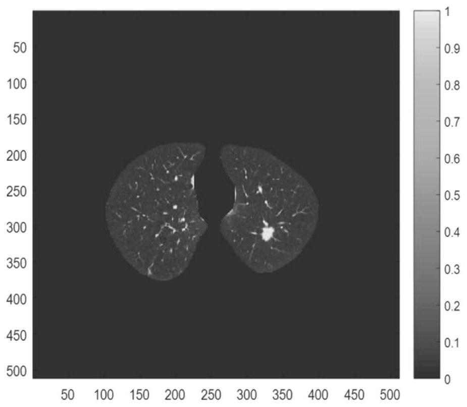 A Nodule Screening Method for Lung CT Images Based on Generalized S-Transform and Teager Attributes