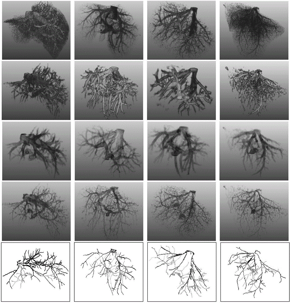 Blood vessel segmentation method for liver CTA sequence image