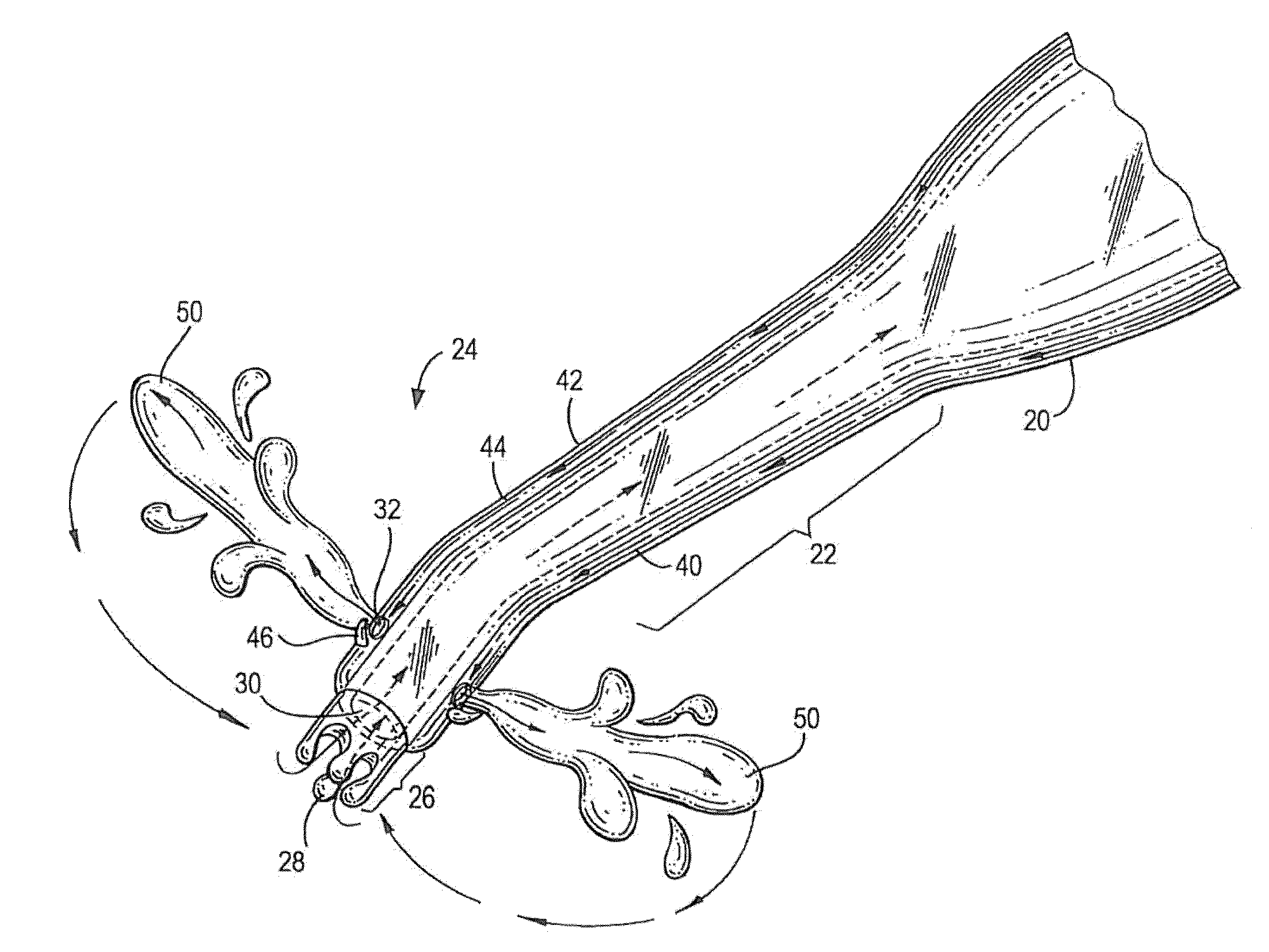 Apparatus and method for performing phacoemulsification