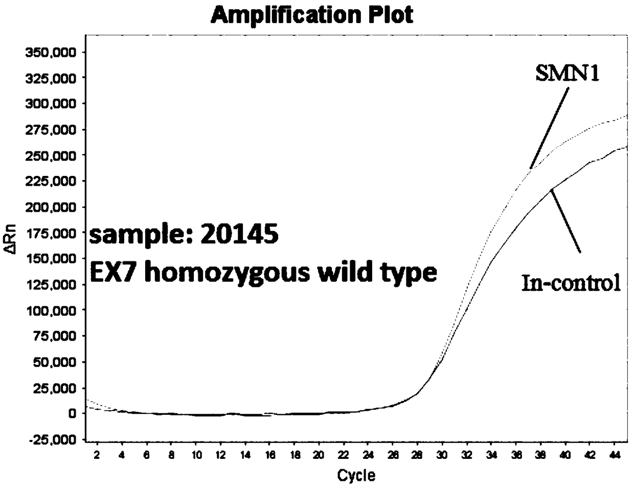 Gene detection kit and method for screening SMA genetic diseases