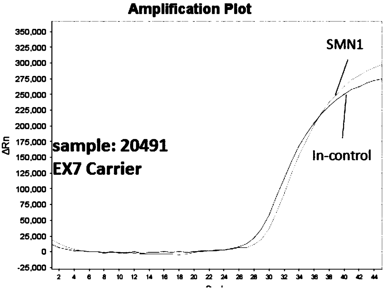 Gene detection kit and method for screening SMA genetic diseases