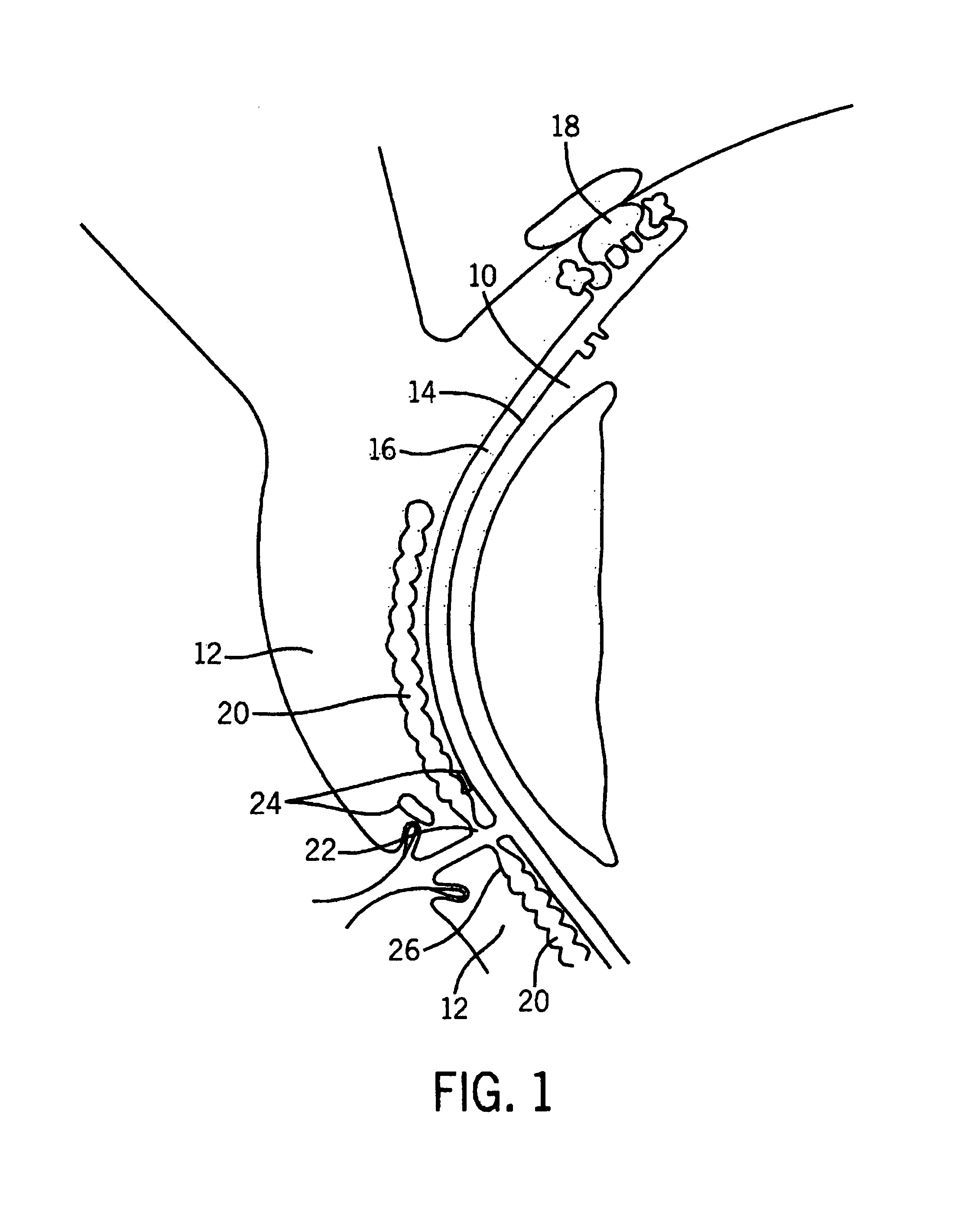 Method and apparatus for preventing and treating eyelid problems