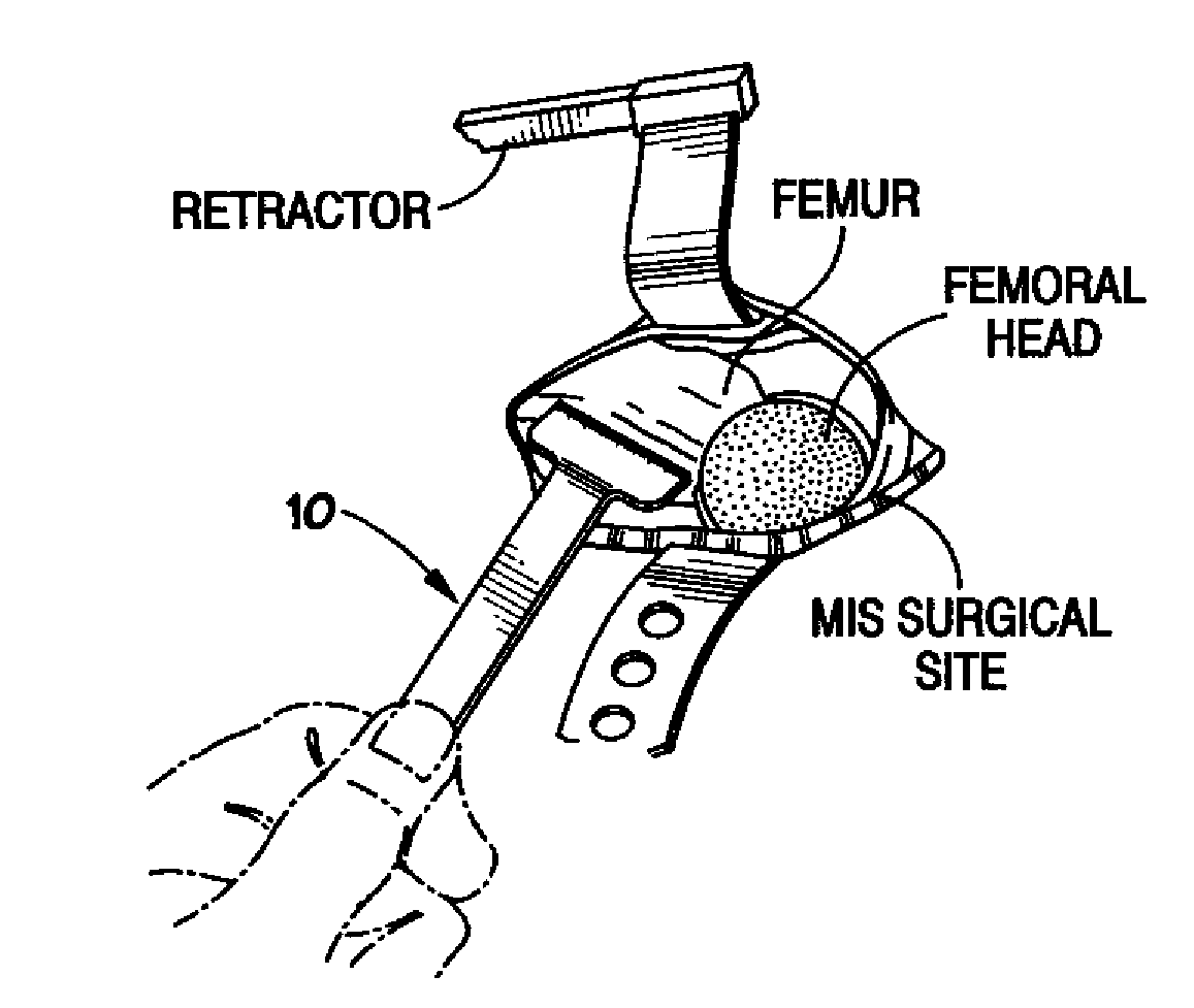 Method of using T-handle rulers in minimally invasive hip surgery