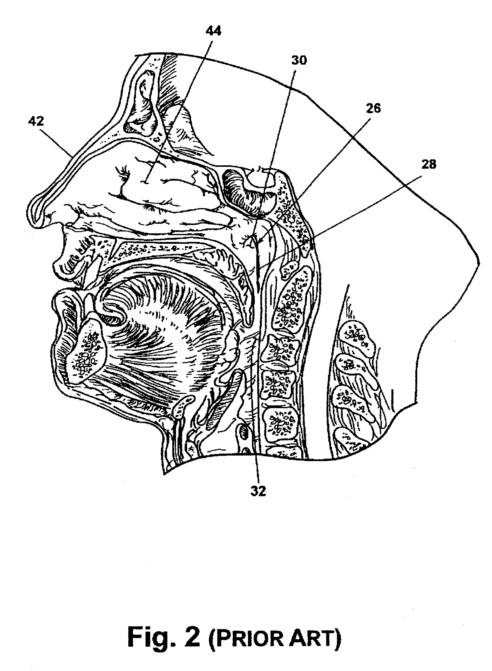 Method and System for Accessing, Diagnosing and Treating Target Tissue Regions Within the Middle Ear and the Eustachian Tube