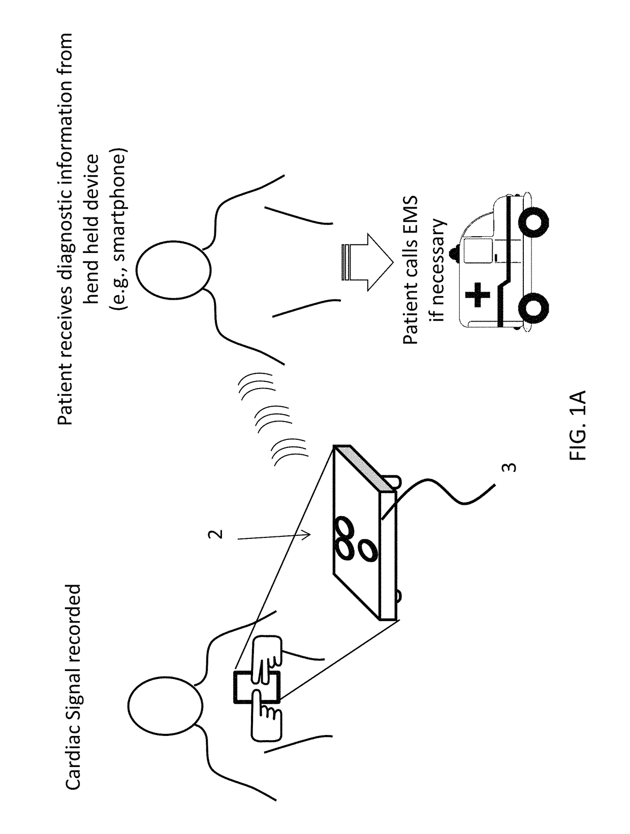 Mobile three-lead cardiac monitoring device and method for automated diagnostics