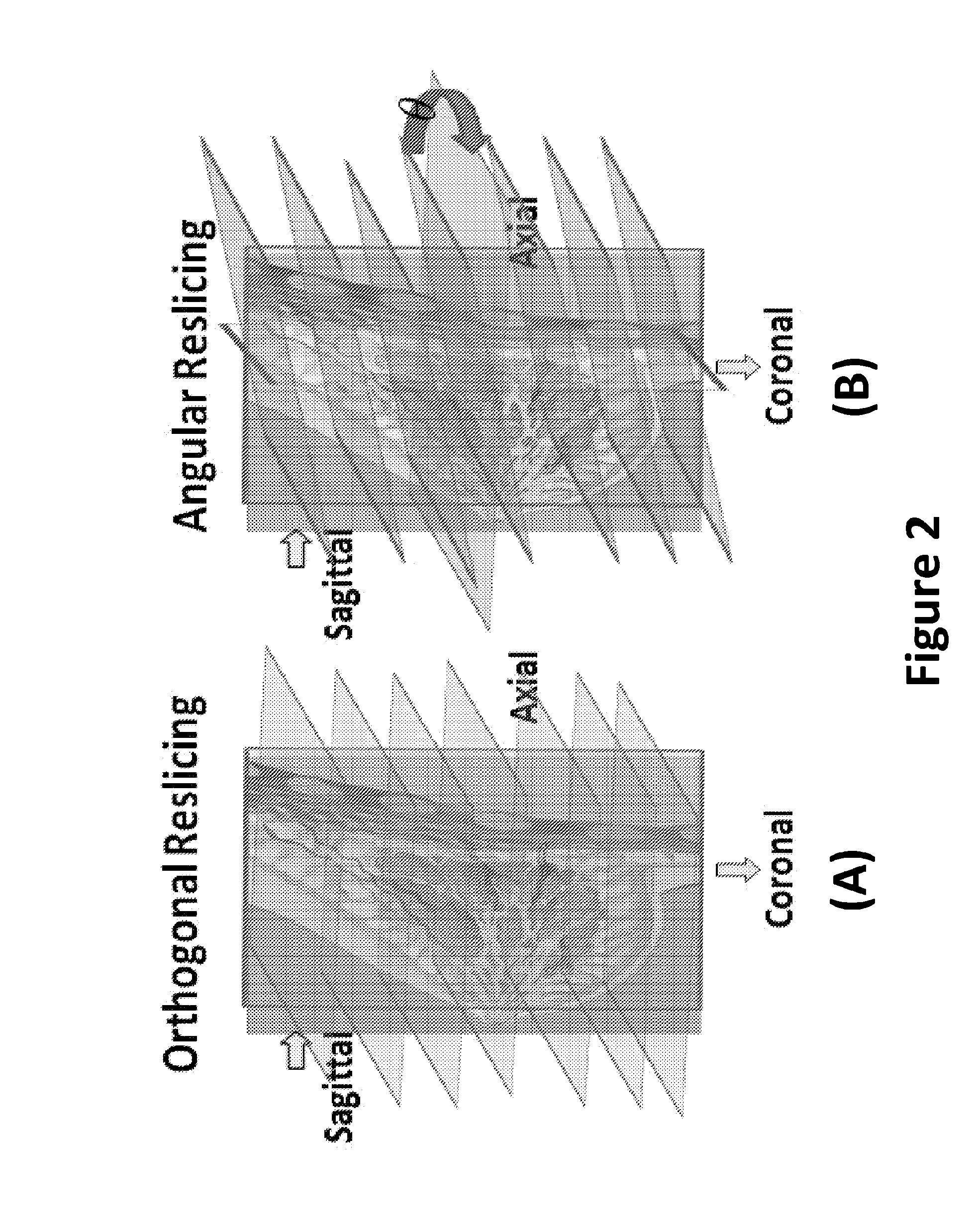 Methods and systems for registration of radiological images