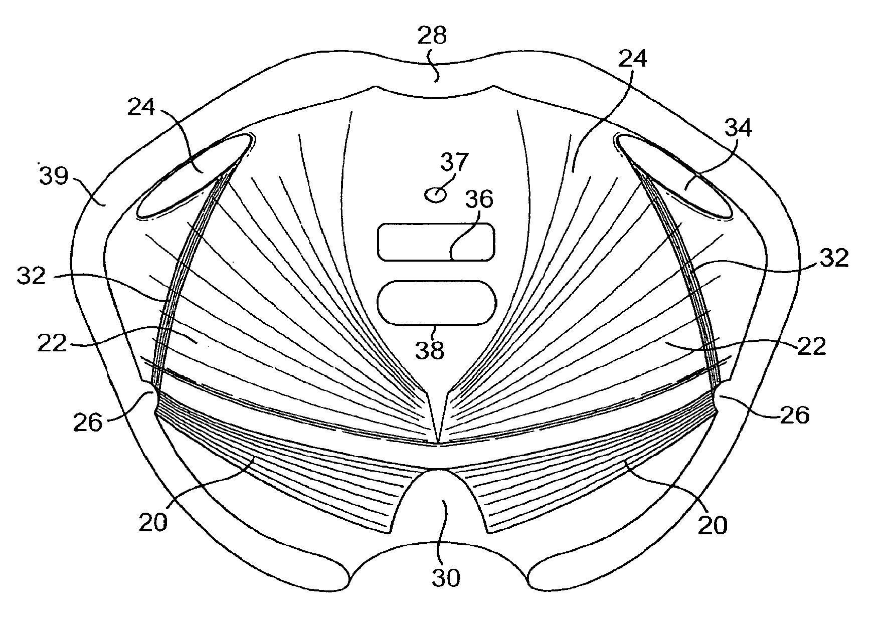 Minimally invasive levator avulsion repair