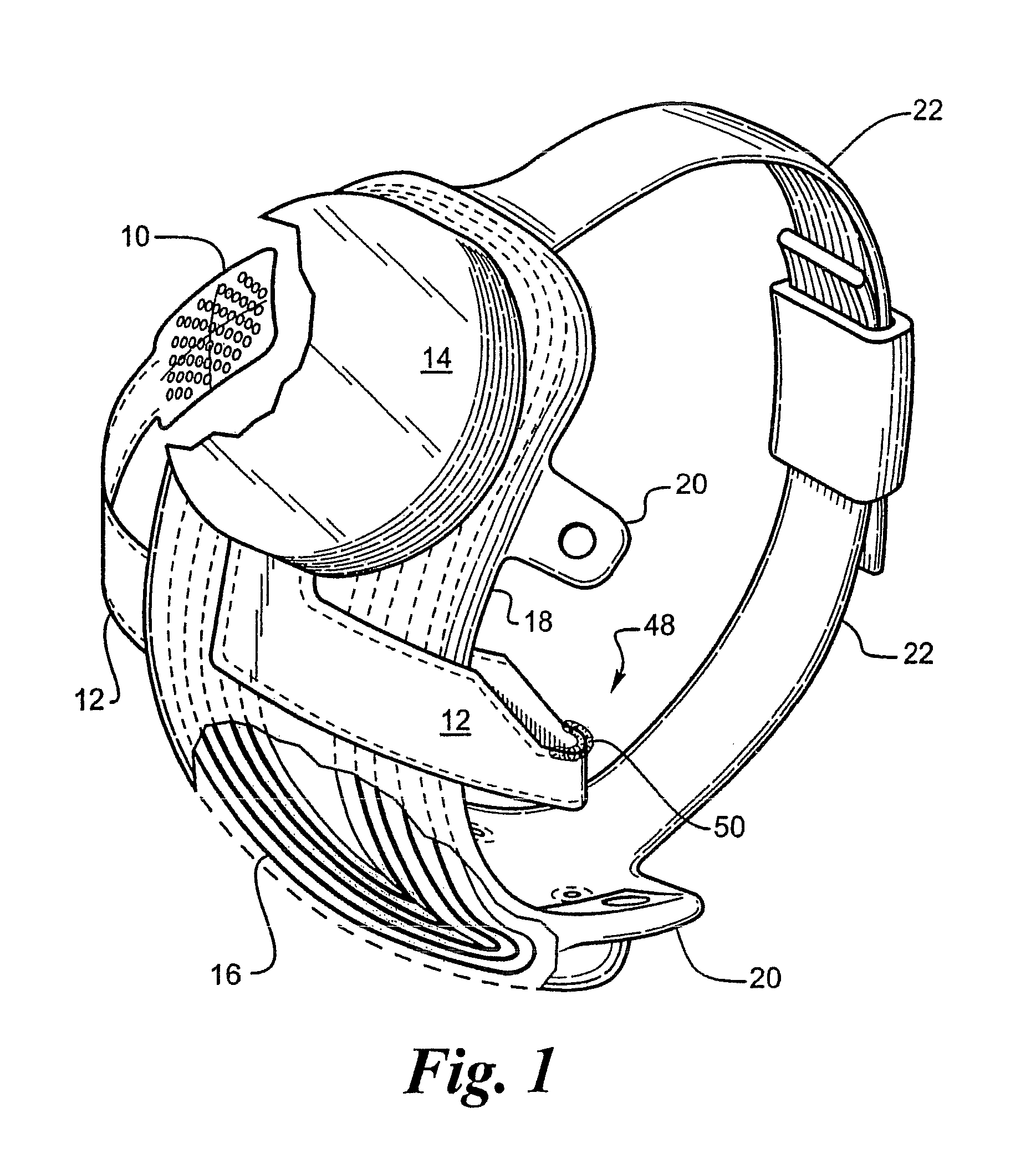 Method of manufacturing a flexible circuit electrode array