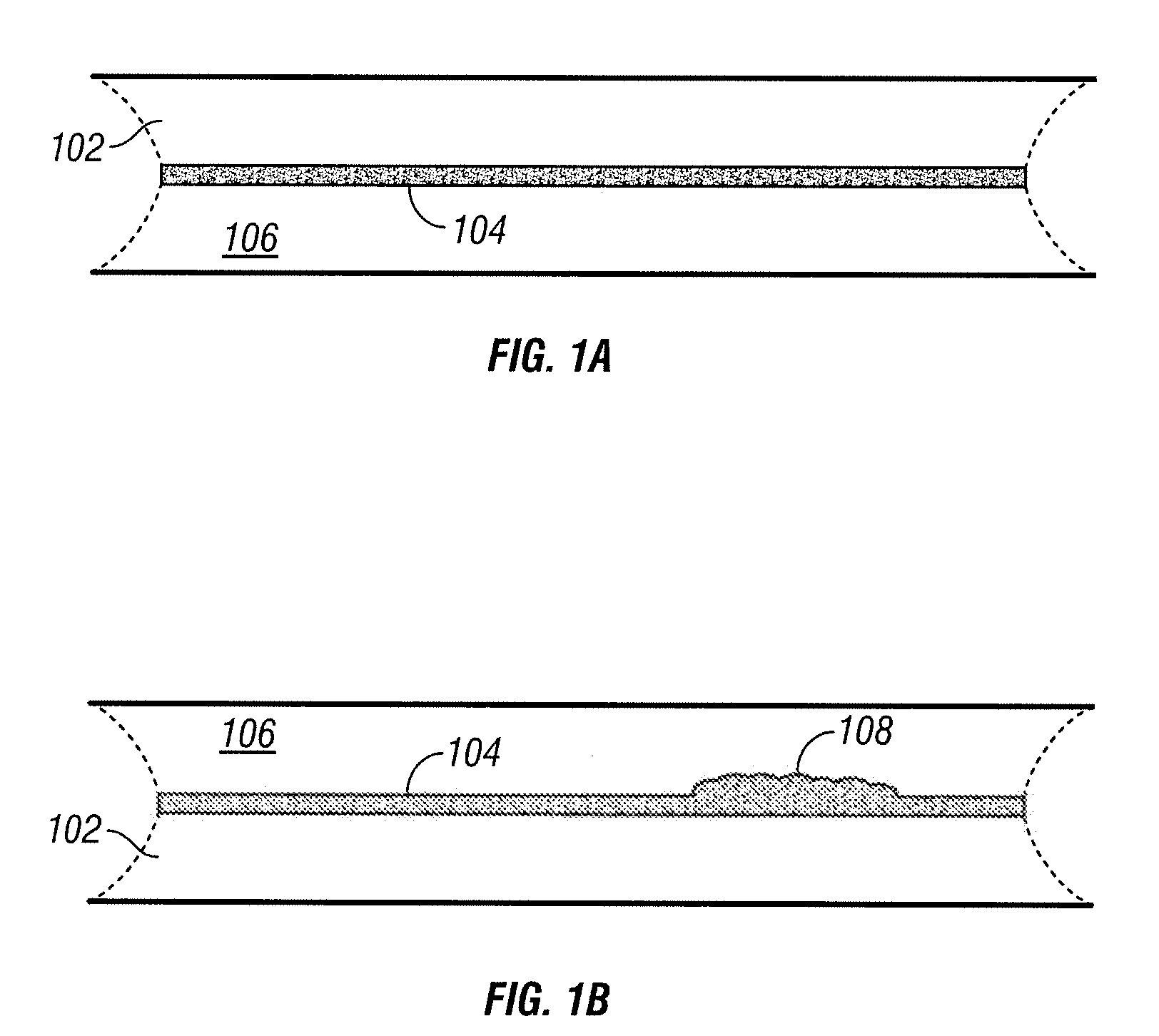 Method and system for detecting corrosion under insulation