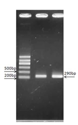 Preparation method of shiga-like toxin Stx1B oral vaccine and product of shiga-like toxin Stx1B oral vaccine