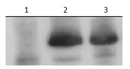 Preparation method of shiga-like toxin Stx1B oral vaccine and product of shiga-like toxin Stx1B oral vaccine