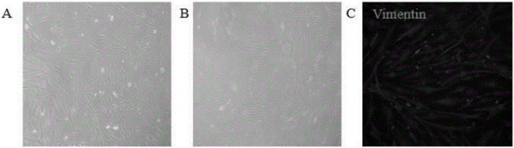 Method for promoting function and characteristic of corneal endothelial cells