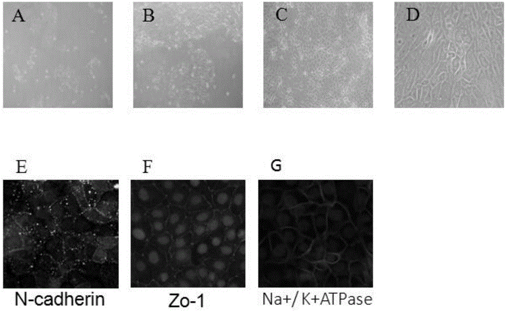 Method for promoting function and characteristic of corneal endothelial cells