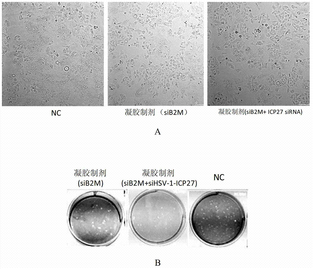 Antiviral small nucleic acid and temperature-sensitive type gel preparation and application thereof