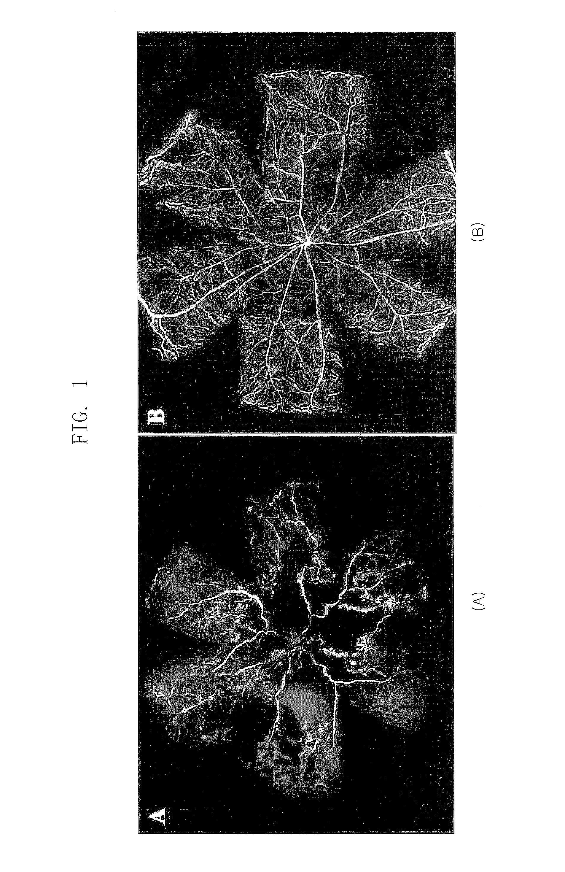 Composition for Treating Retinopathy or Glaucoma Comprising Thrombin Derived Peptides