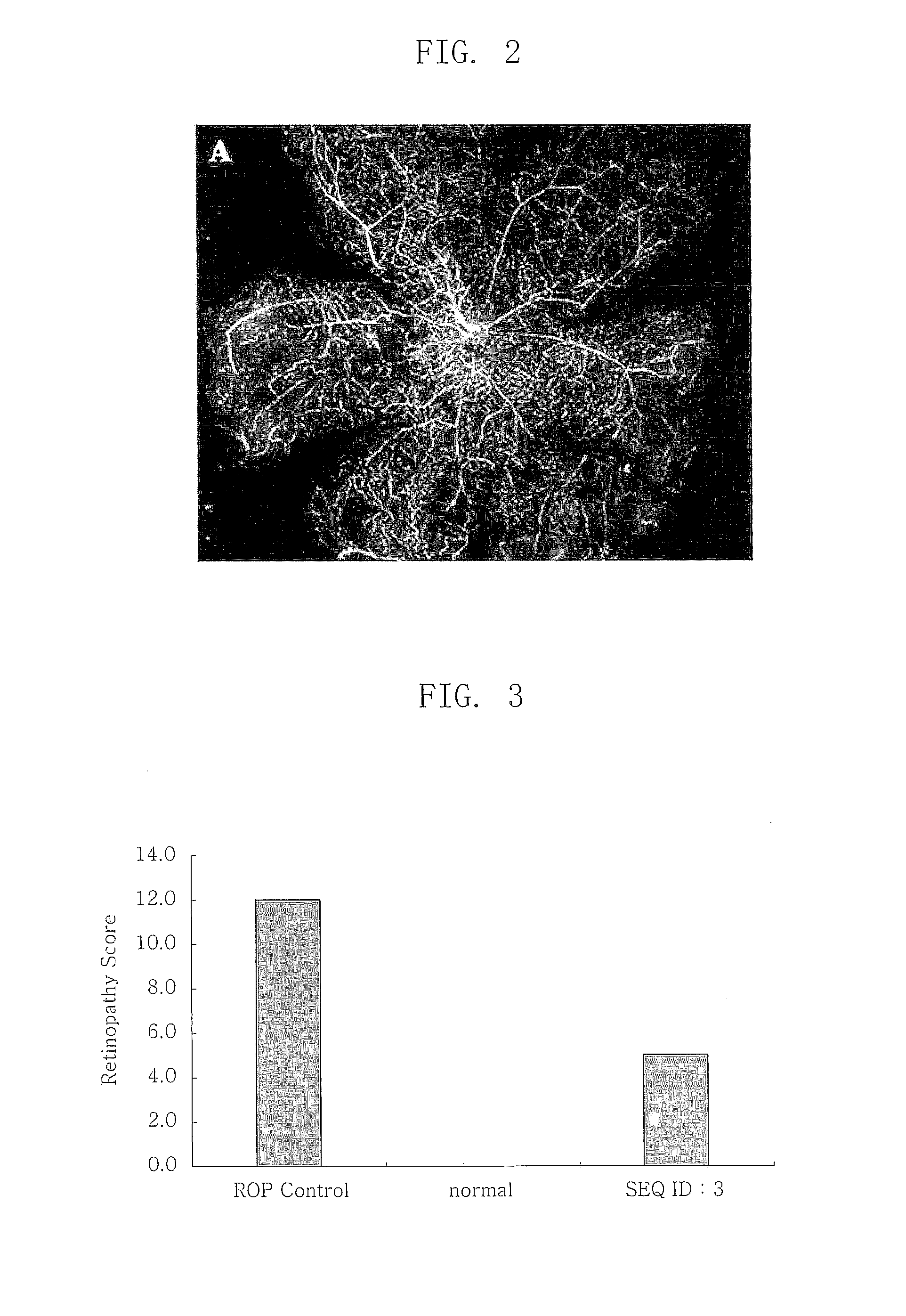 Composition for Treating Retinopathy or Glaucoma Comprising Thrombin Derived Peptides