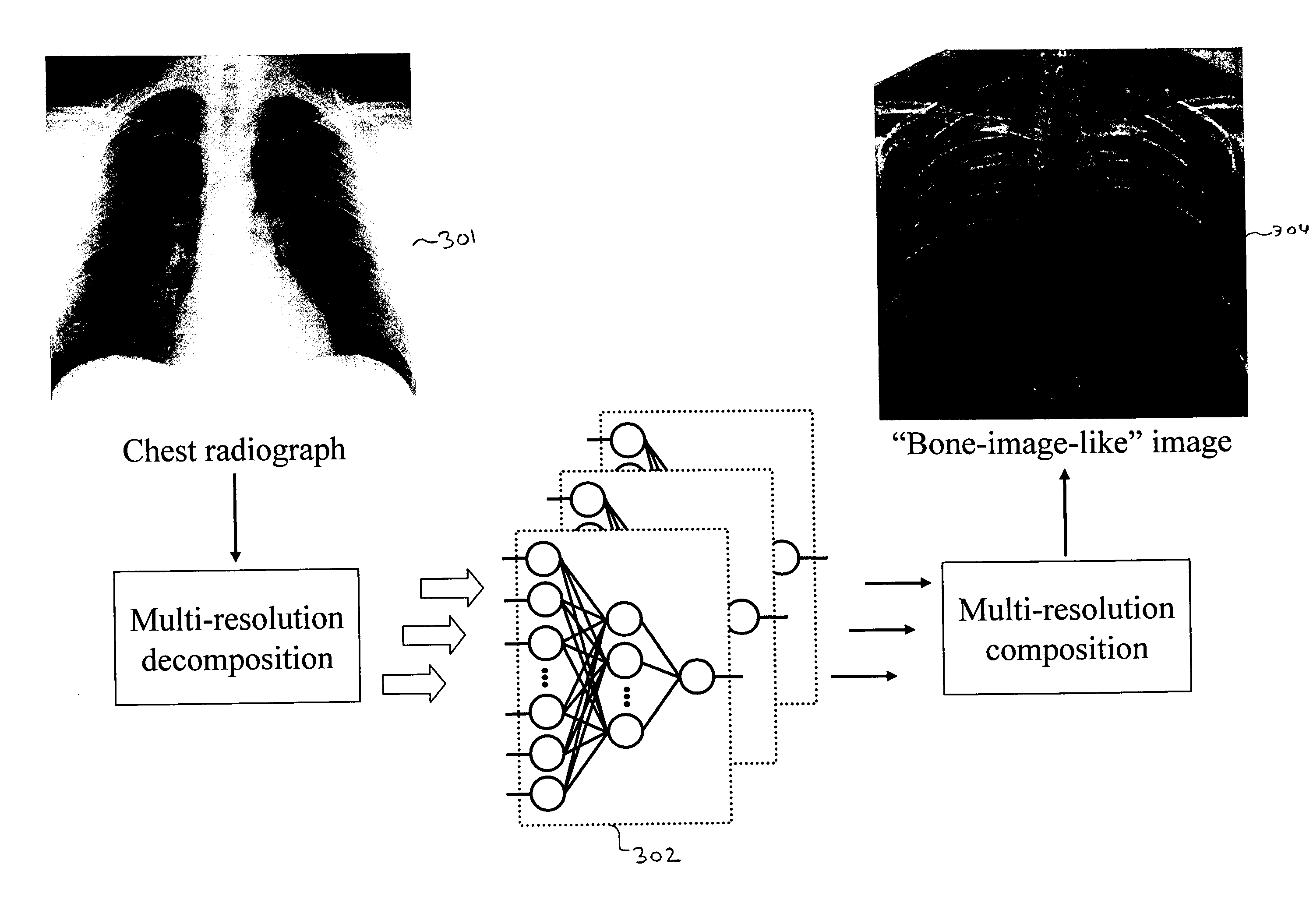 Image modification and detection using massive training artificial neural networks (MTANN)