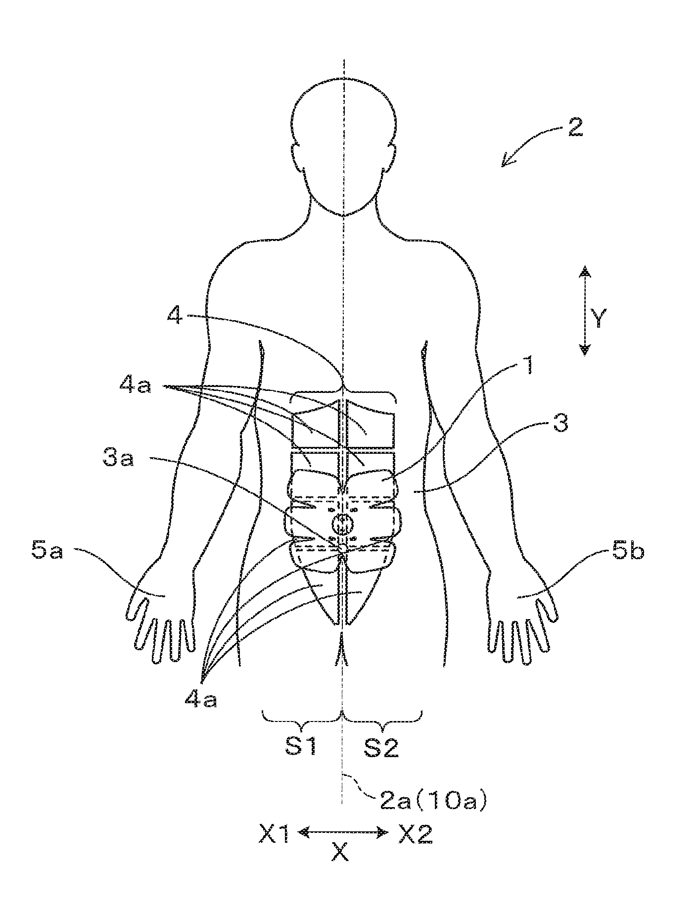 Electrical muscle stimulation device