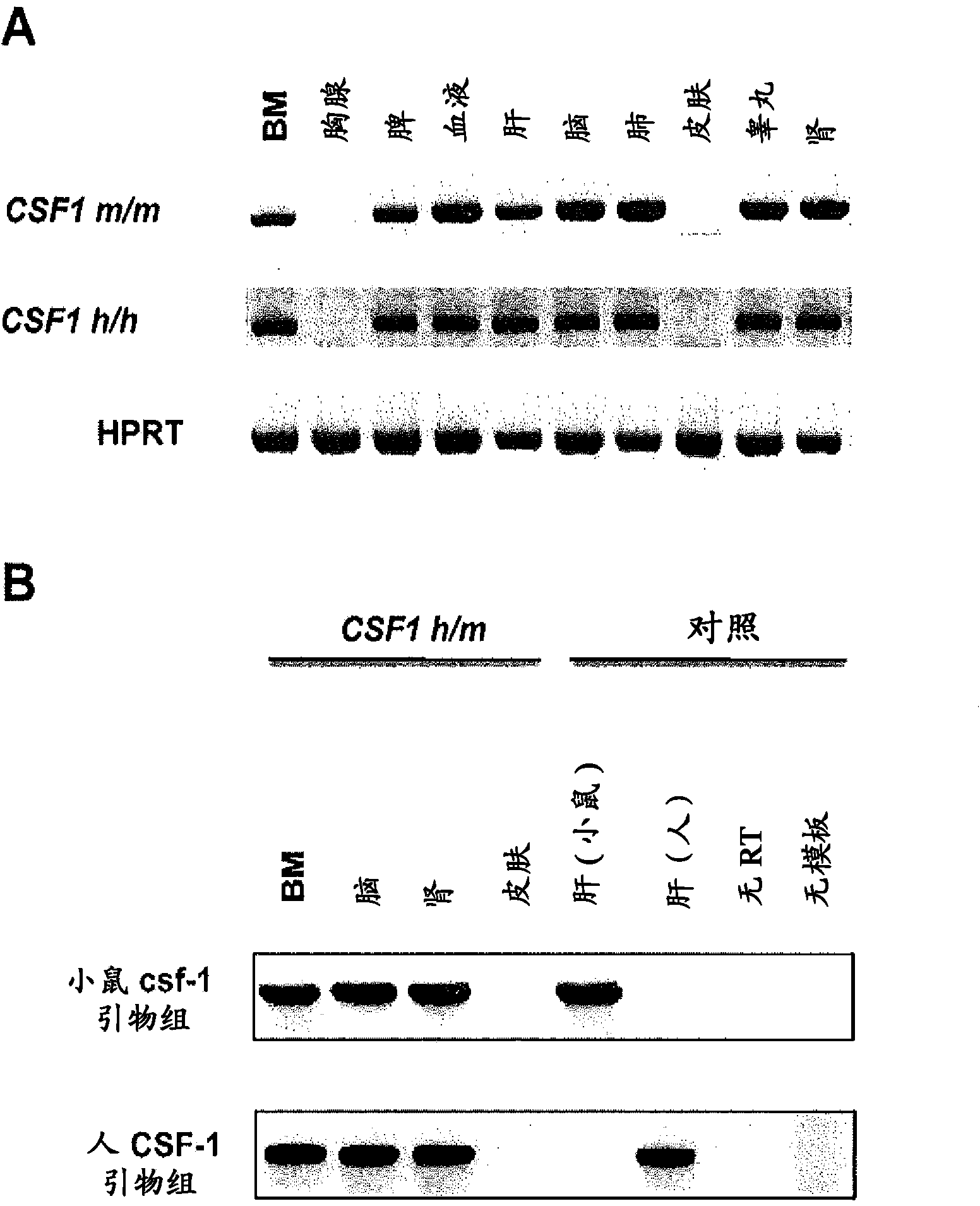 Humanized M-CSF mice