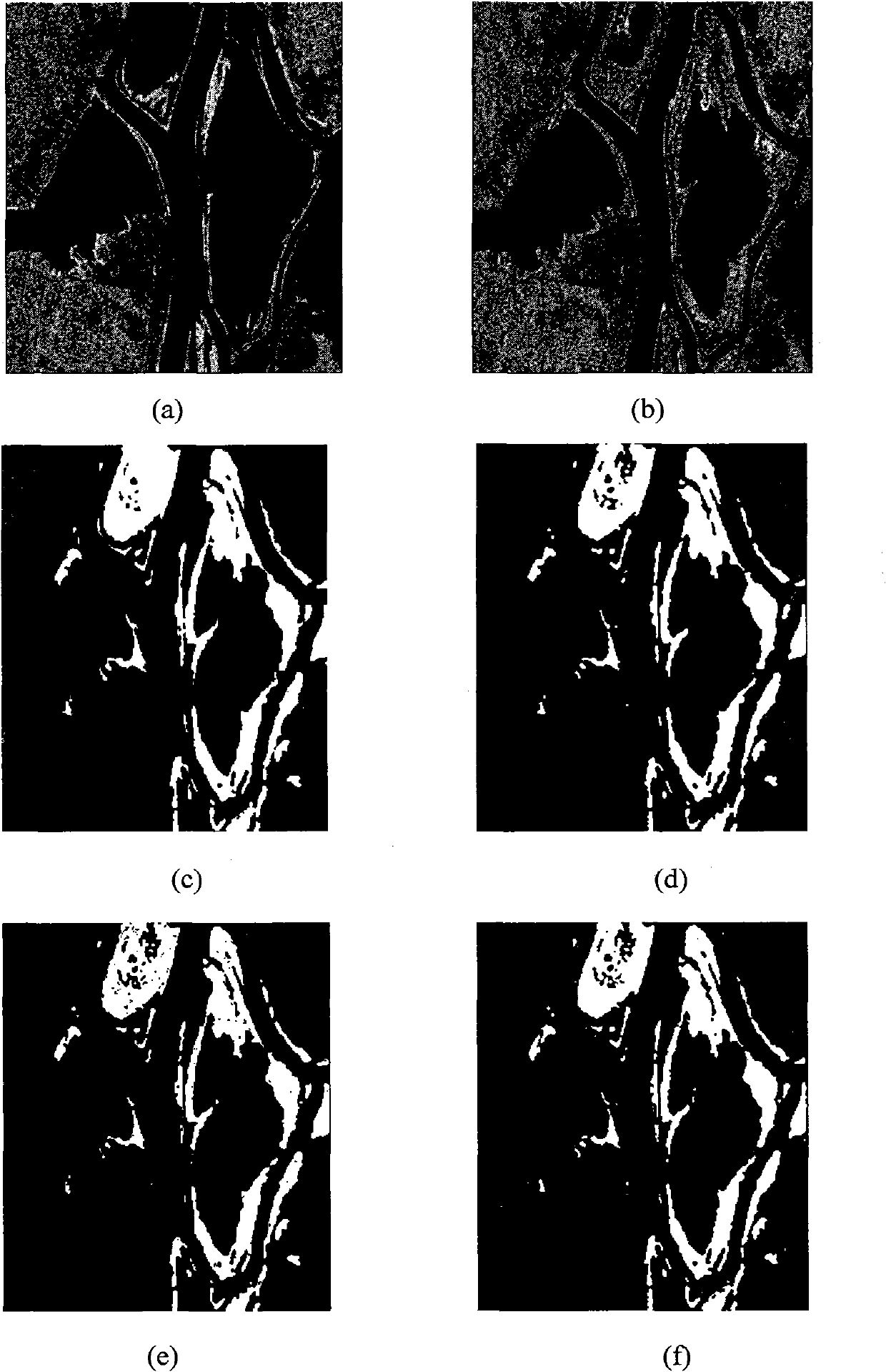 SAR image change detection method based on quantum-inspired immune clone
