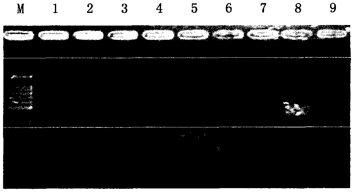 Reverse transcription polymerase chain reaction (PCR) method for detecting tubercle bacillus infection from clinical specimen