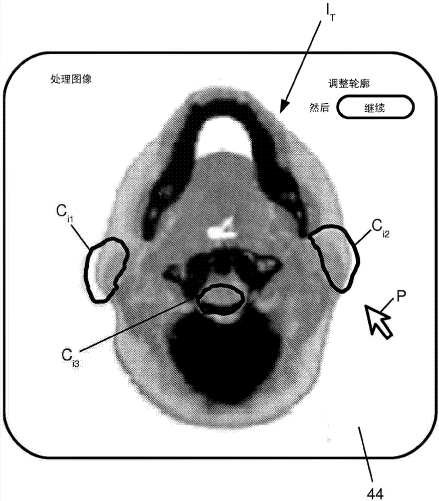 Integration of user inputs and correction of deformation vector field in deformable image registration workflow