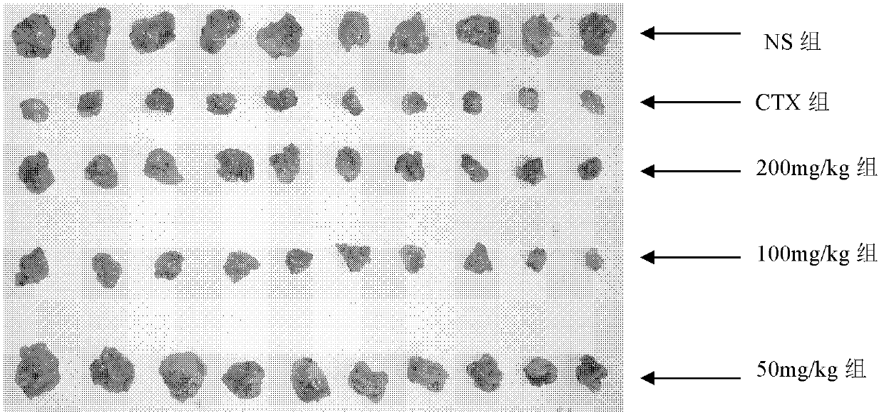 Curcumin salicylic acid monoester and synthesis method thereof and application curcumin salicylic acid monoester to anti-tumor and anti-inflammatory aspects